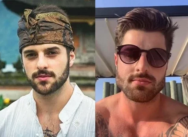 Impressionante! Veja o antes e depois de famosos que fizeram harmonização - imagem 66270