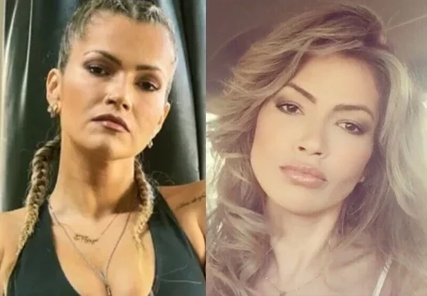 Impressionante! Veja o antes e depois de famosos que fizeram harmonização - imagem 66278