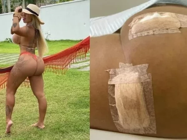 Juju Ferrari gasta R$ 50 mil em procedimento no bumbum que deu errado