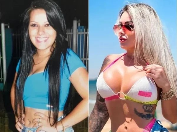  Após plásticas, influencer desabafa: “As famosas fazem, só não contam”
