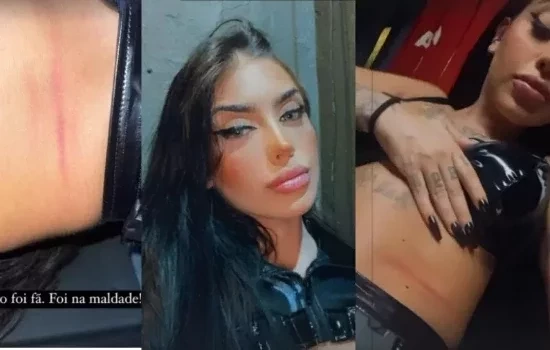 Mirella sofre agressão de fã e expõe marcas; veja outros famosos agredidos 