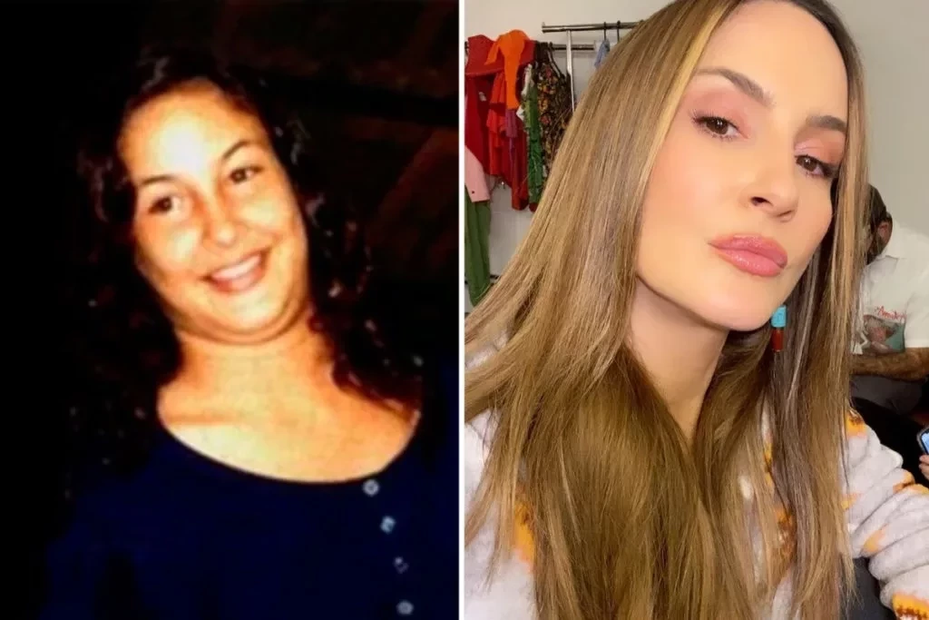 Eles eram irreconhecíveis: supreenda-se com o antes e depois dos famosos - imagem 73277