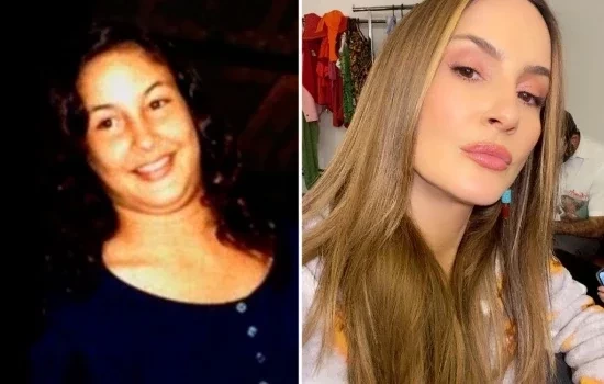 Eles eram irreconhecíveis: supreenda-se com o antes e depois dos famosos