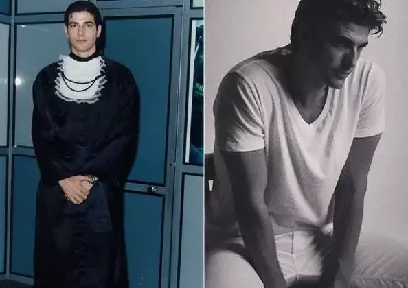 Eles eram irreconhecíveis: supreenda-se com o antes e depois dos famosos - imagem 73275