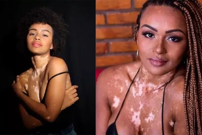 Mudaram muito! Confira o antes e depois dos participantes do BBB22 - imagem 73430