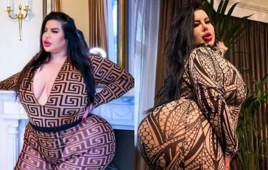 Maior bumbum do mundo: Veja fotos da influencer que tenta bater recorde