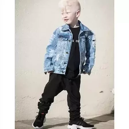 Modelo: Com síndrome rara, menino faz sucesso na web - imagem 75476