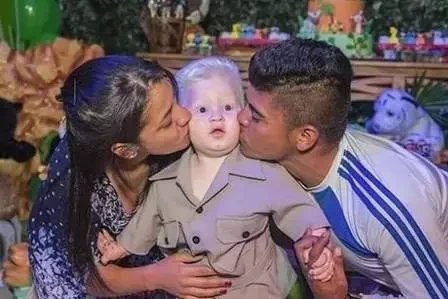 Modelo: Com síndrome rara, menino faz sucesso na web - imagem 75478