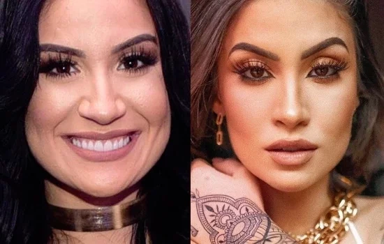 Impressionante: veja antes e depois das famosas que fizeram rinoplastia