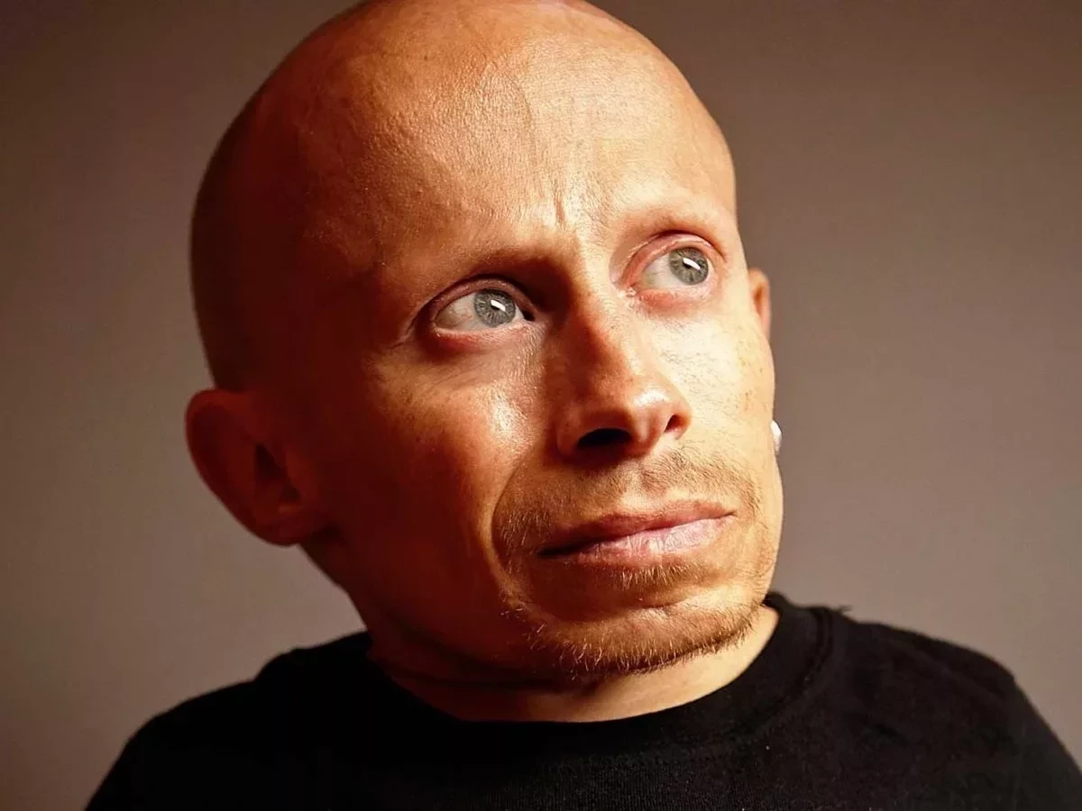 Harry Potter: Listamos 10 atores do filme que morreram e você não sabia - imagem 78870