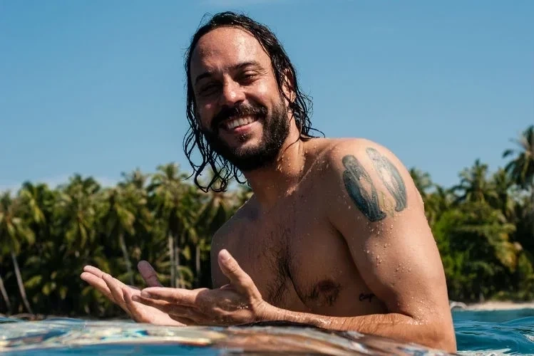 Além de Juliette: 7 famosos que, como Jada Smith, também sofrem de alopecia - imagem 79484