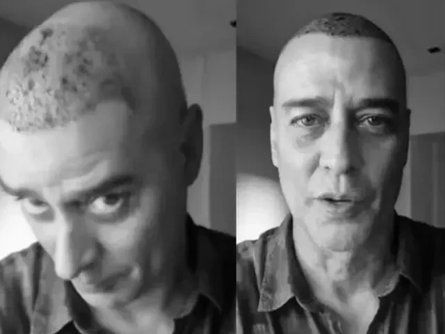 Veja famosos que já fizeram transplante capilar e saiba como ficou - imagem 76757