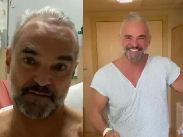 Veja famosos que já fizeram transplante capilar e saiba como ficou - imagem 76754