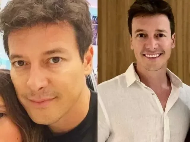 Veja famosos que já fizeram transplante capilar e saiba como ficou - imagem 76724