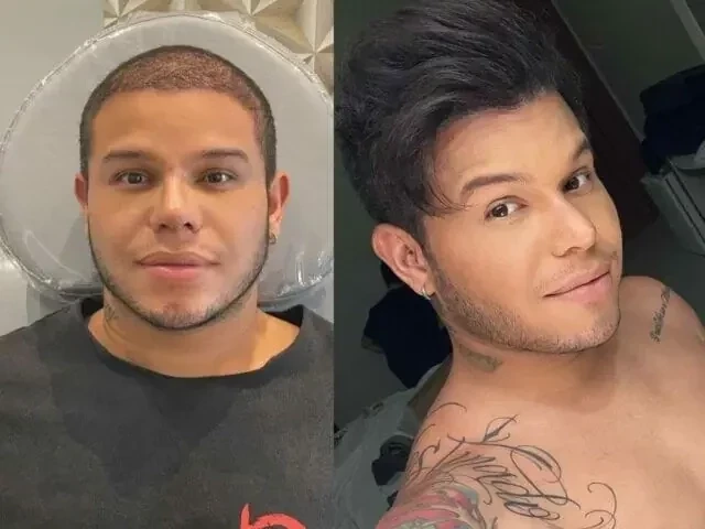 Veja famosos que já fizeram transplante capilar e saiba como ficou - imagem 76753