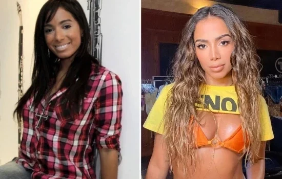 Versões de Anitta: veja mudanças da cantora após cada cirurgia plástica