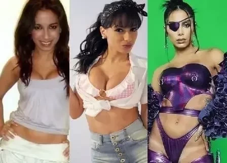 Versões de Anitta: veja mudanças da cantora após cada cirurgia plástica - imagem 79786