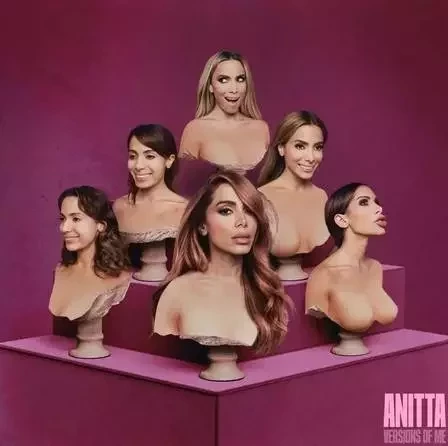 Versões de Anitta: veja mudanças da cantora após cada cirurgia plástica - imagem 79785
