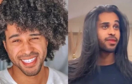 BBB22:Harmonização, facetas, visual novo; veja antes e depois dos brothers 