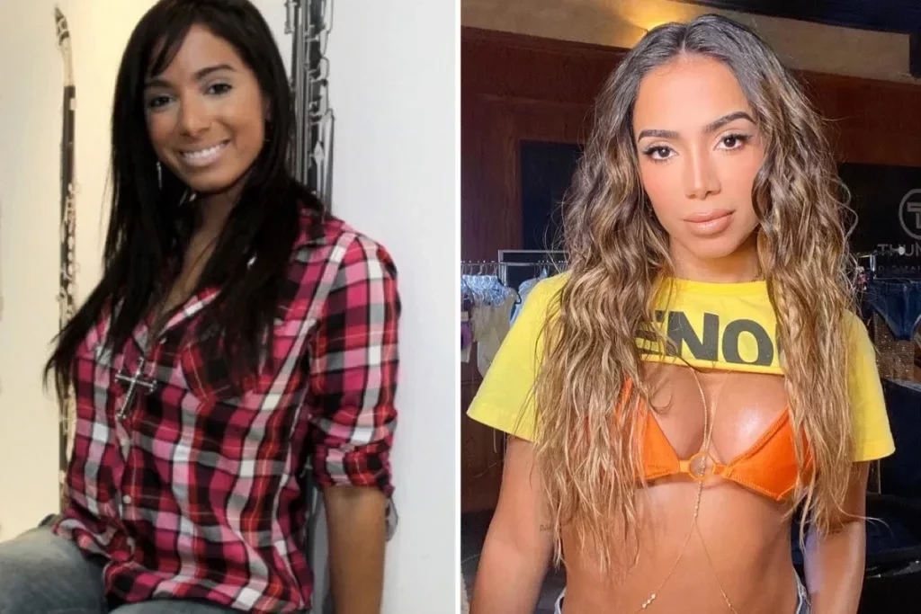 Antes e depois: veja como eram os famosos antes da fama e como estão hoje - imagem 79922