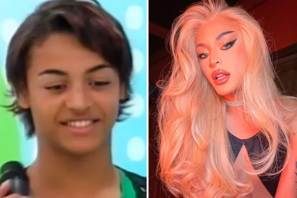 Antes e depois: veja como eram os famosos antes da fama e como estão hoje - imagem 79915