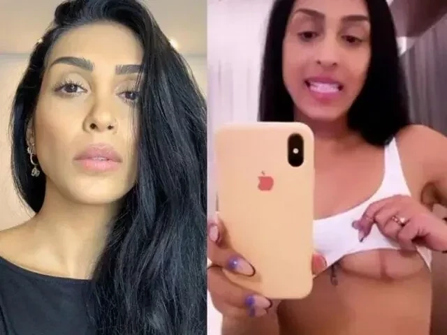 Confira quais famosas que já fizeram procedimentos estéticos malsucedidos - imagem 84620