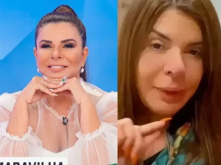 Confira quais famosas que já fizeram procedimentos estéticos malsucedidos - imagem 84622