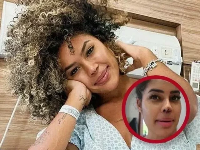 Confira quais famosas que já fizeram procedimentos estéticos malsucedidos - imagem 84621