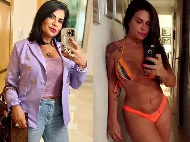 Confira quais famosas que já fizeram procedimentos estéticos malsucedidos - imagem 84619