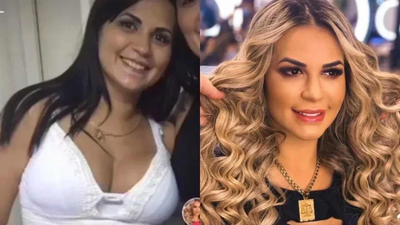 Saiba quais cirurgias estéticas Deolane já fez: "até nas partes íntimas" - imagem 82594