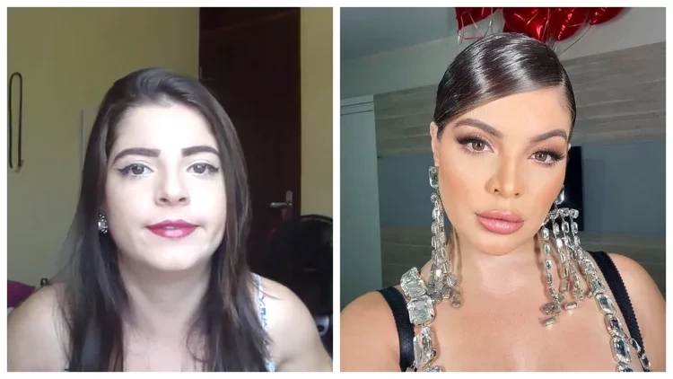 Uma fortuna! Veja quanto Gkay já gastou com procedimentos estéticos - imagem 86591