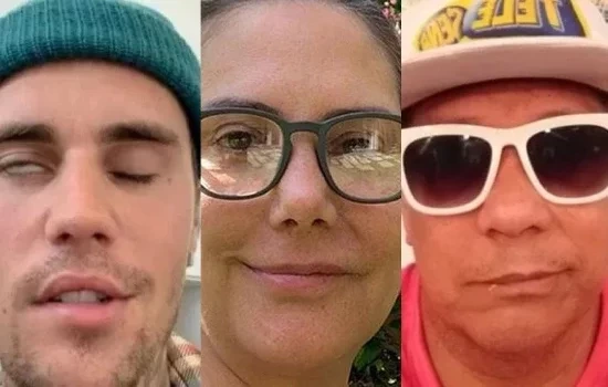 Além de Justin Bieber, relembre famosos que já tiveram paralisia facial