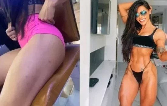 Musa do OnlyFans diz que quase morreu com remédio para cavalo; fotos