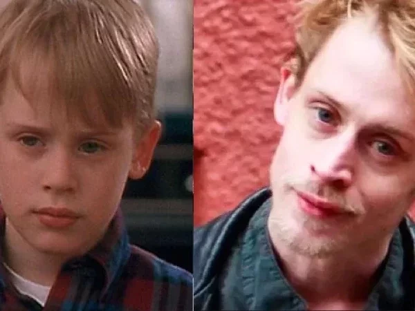 Você vai se surpreender com celebridades que envelheceram terrivelmente 