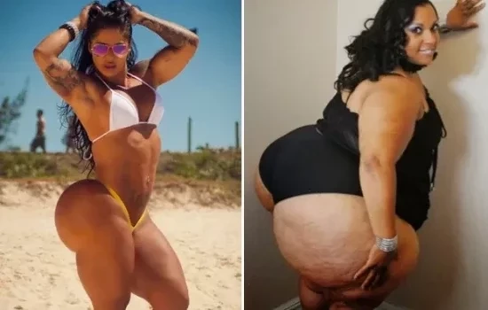 Brasileira com bumbum de 126cm quer bater recorde mundial e chegar a 250cm