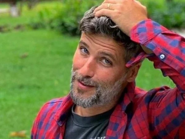 Disfarçados! 15 Famosos que escondem as carecas e você não sabia