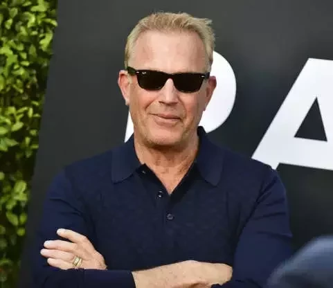 Disfarçados! 15 Famosos que escondem as carecas e você não sabia - imagem 91943