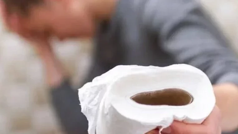 Cuidados com a limpeza da bunda