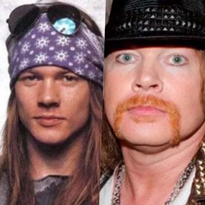 Axl Rose