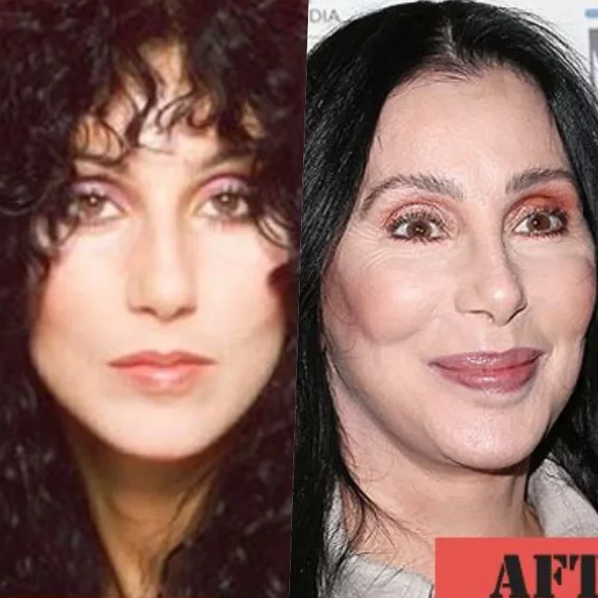 Cher