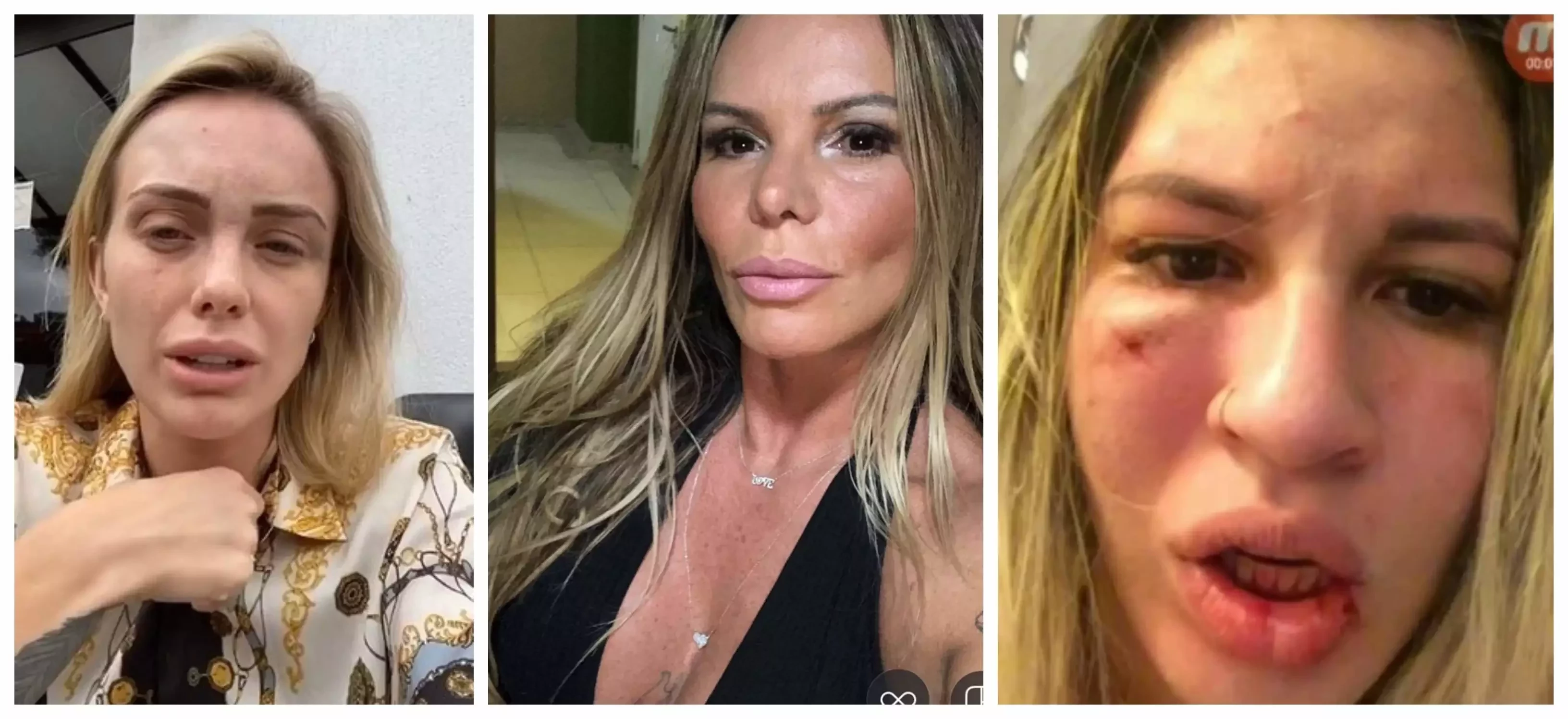 Confira quem são as famosas que já foram agredidas por seus companheiros - imagem 94663