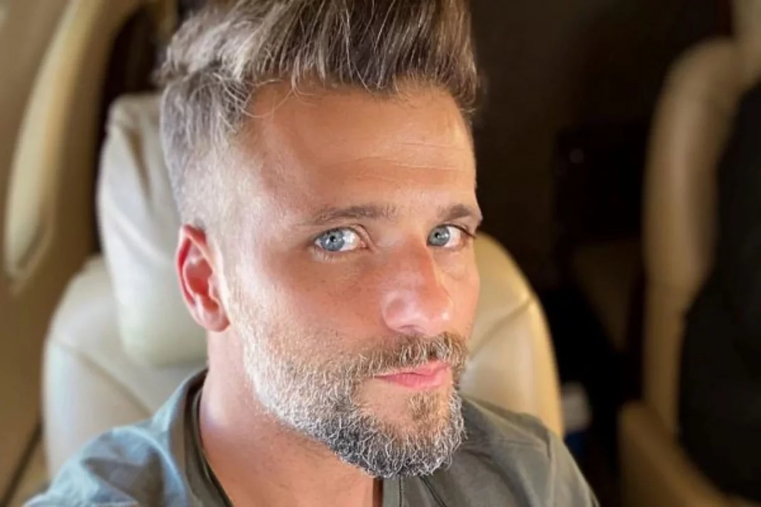 Saiba 10 famosos que fizeram implante de cabelo e se surpreenda - imagem 102076