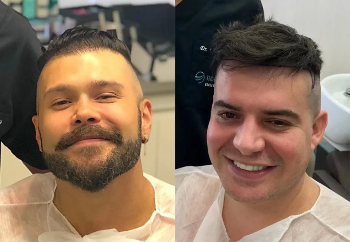 Saiba 10 famosos que fizeram implante de cabelo e se surpreenda - imagem 102080