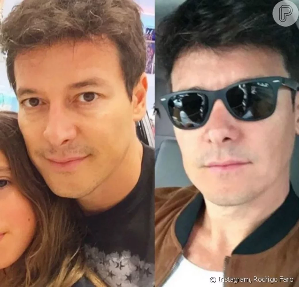 Saiba 10 famosos que fizeram implante de cabelo e se surpreenda - imagem 102079