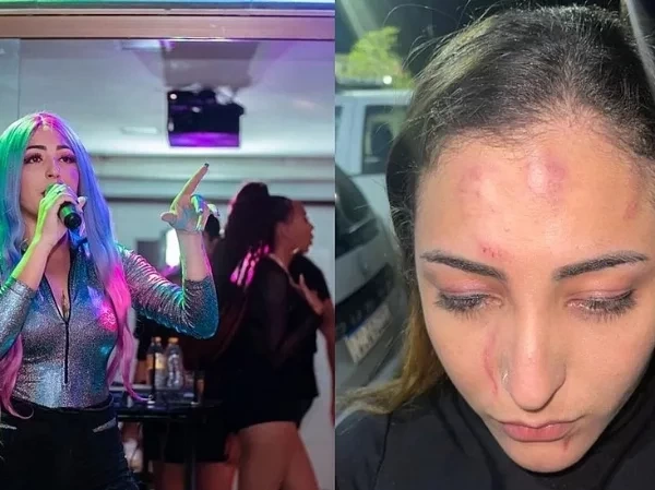 Vocalista da banda Sedutora é espancada por casal antes de show em PE