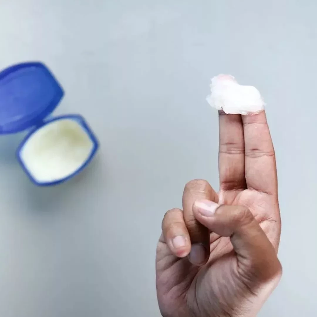 Confira o que você jamais deve usar como lubrificante na hora do sexo - imagem 112545