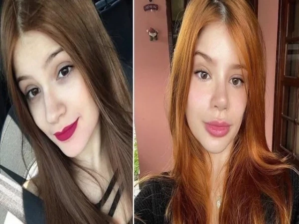 BBB23: Giovana gastou cerca de R$ 150 mil para mudar a aparência; compare