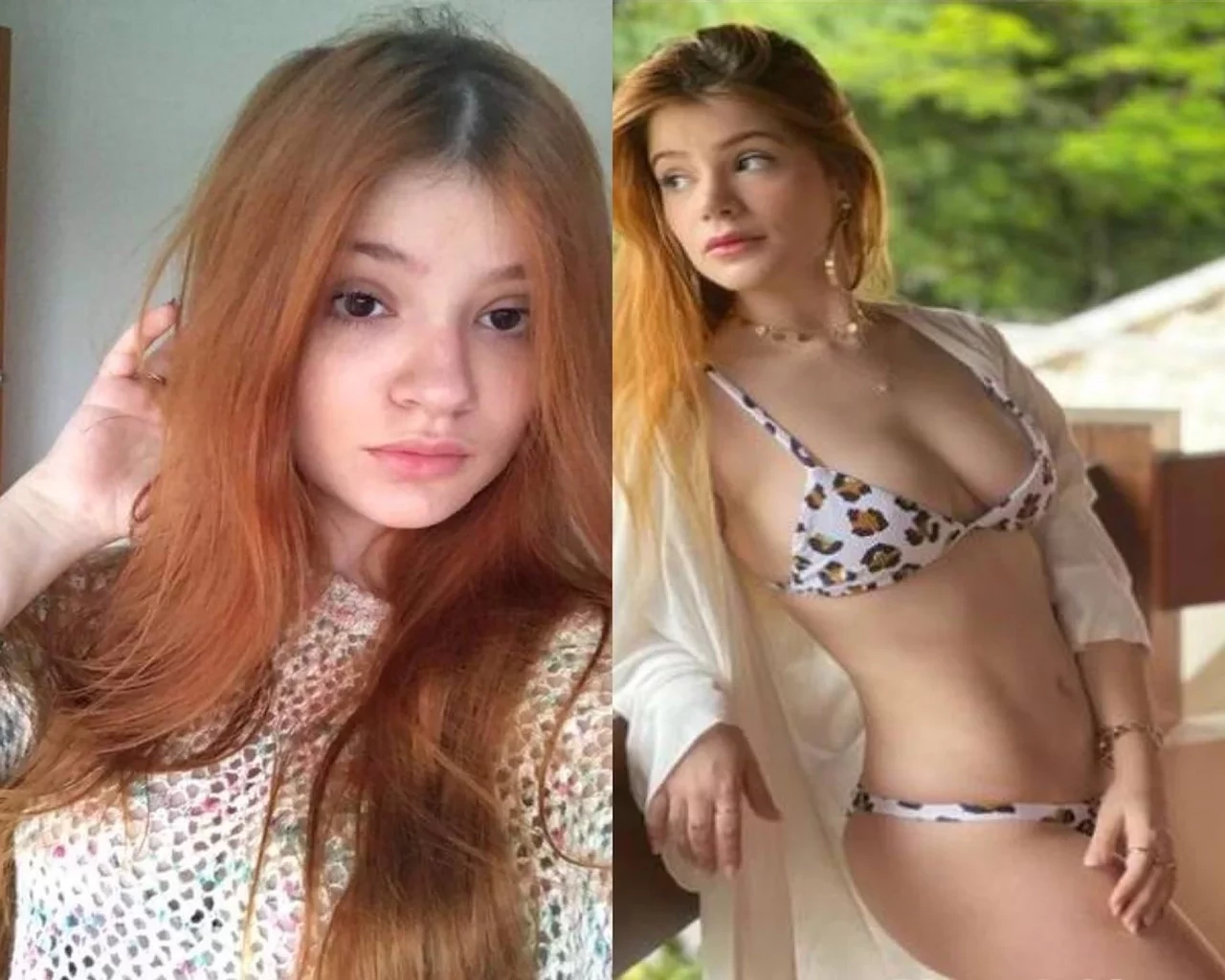 Harmonização facial