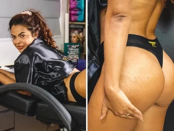Ex-BBB Paula Freitas mostra resultado de tratamento:'Bumbum francês'; fotos