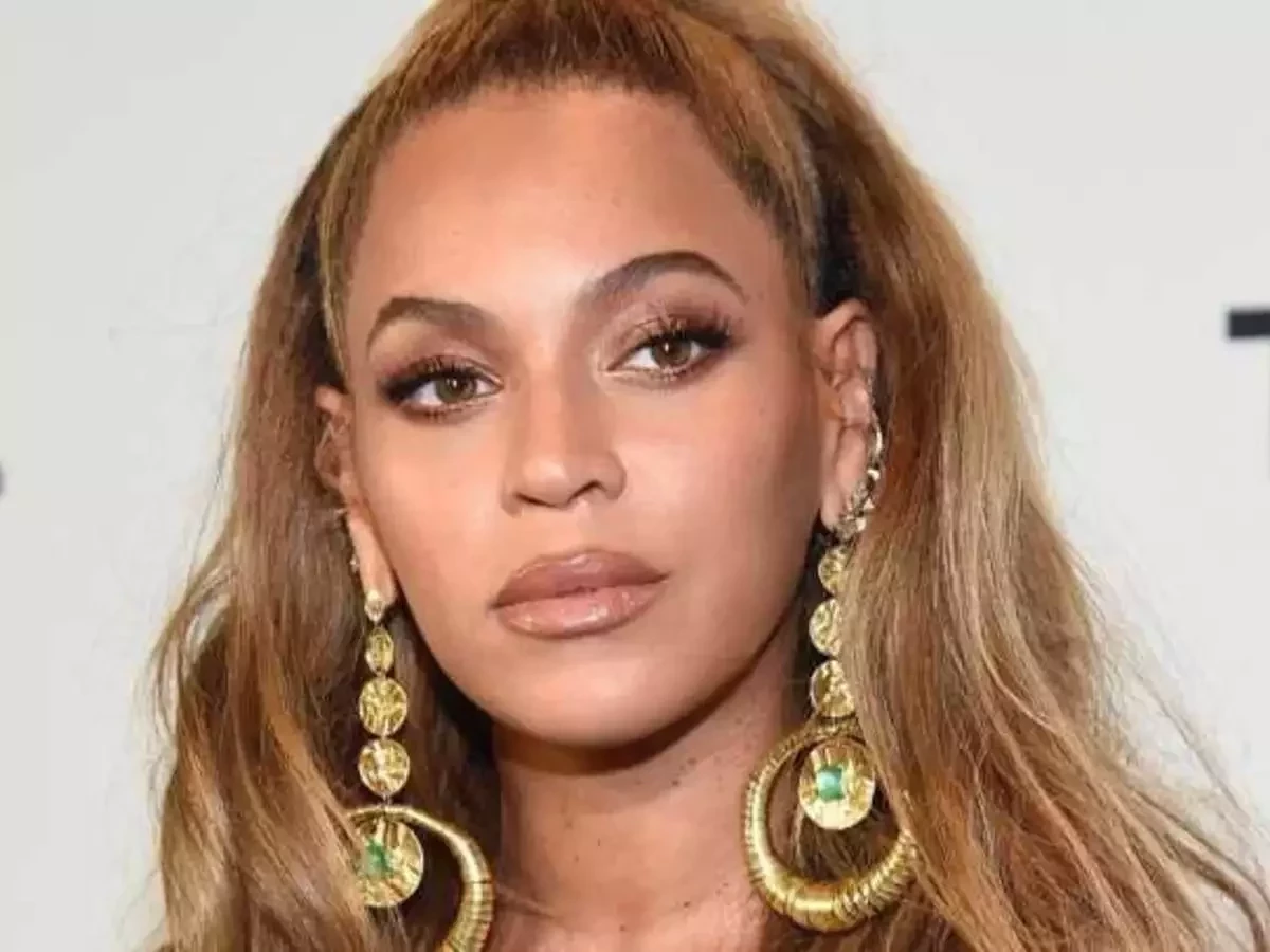 Conheça as famosas que não têm vergonha de mostrar os pelos nas axilas - imagem 119666